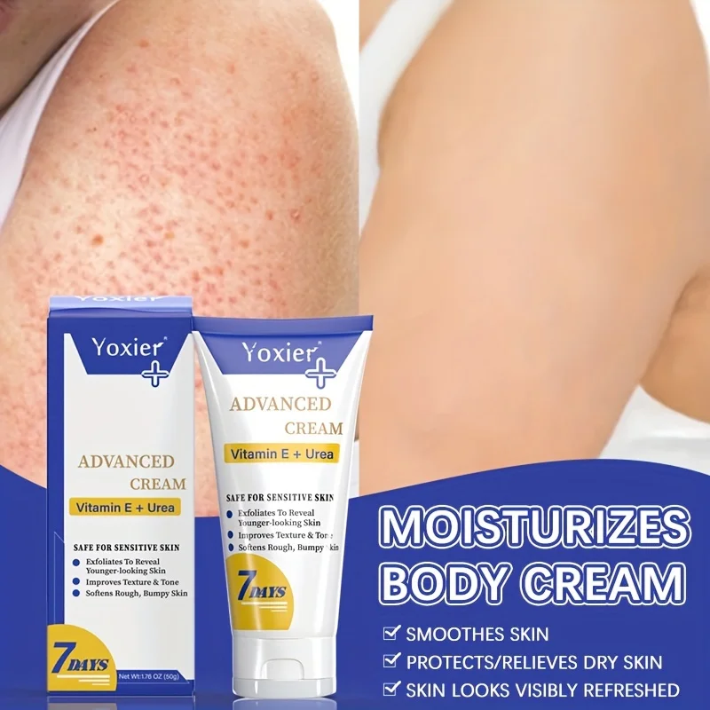 

Body Cream Remove Chicken Skin Treatment Hair Follicle Ameliorate Roughness Bumpy Pore Spots Care Moisturizer Creams