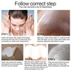 10PCS Nose Blackhead Remover Mask Deep Cleaning Shrink Pore Acne Treatment Mask 2