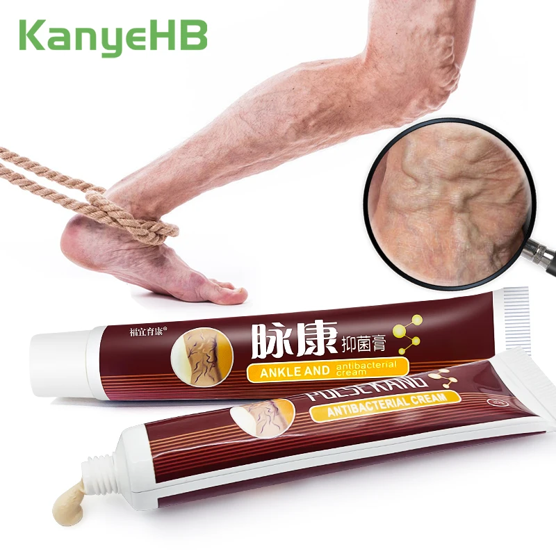 

2pc Varicose Veins Treatment Cream Vasculitis Phlebitis Feet/Leg Body Spider Shape Varicose Veins Remover Medical Plaster A428