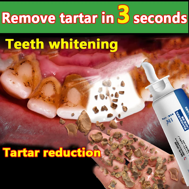 

Probiotic Quick Repair of Cavities Caries Filling Removal of Plaque Stains Decay Whitening Yellowing Repair Teeth Whitening