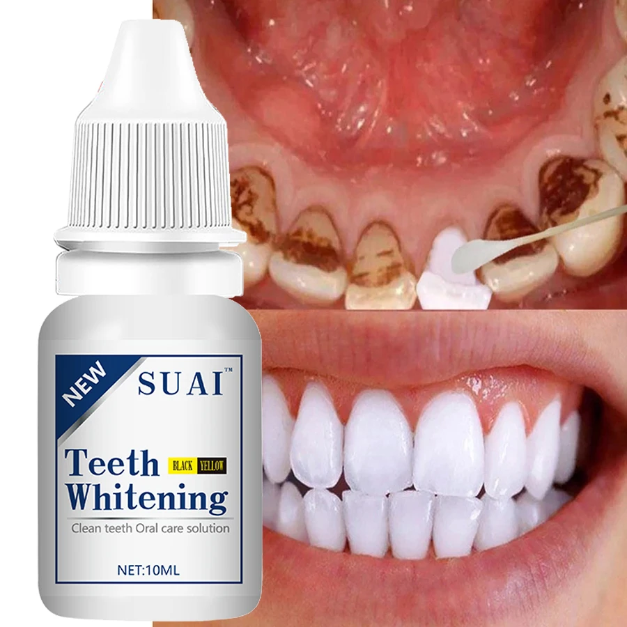 Teeth Whitening Essence Serum Oral Hygiene Care Cleaner Whiten Teeth Whitener Remove Plaque Stains Fresh Breath Dental Tools