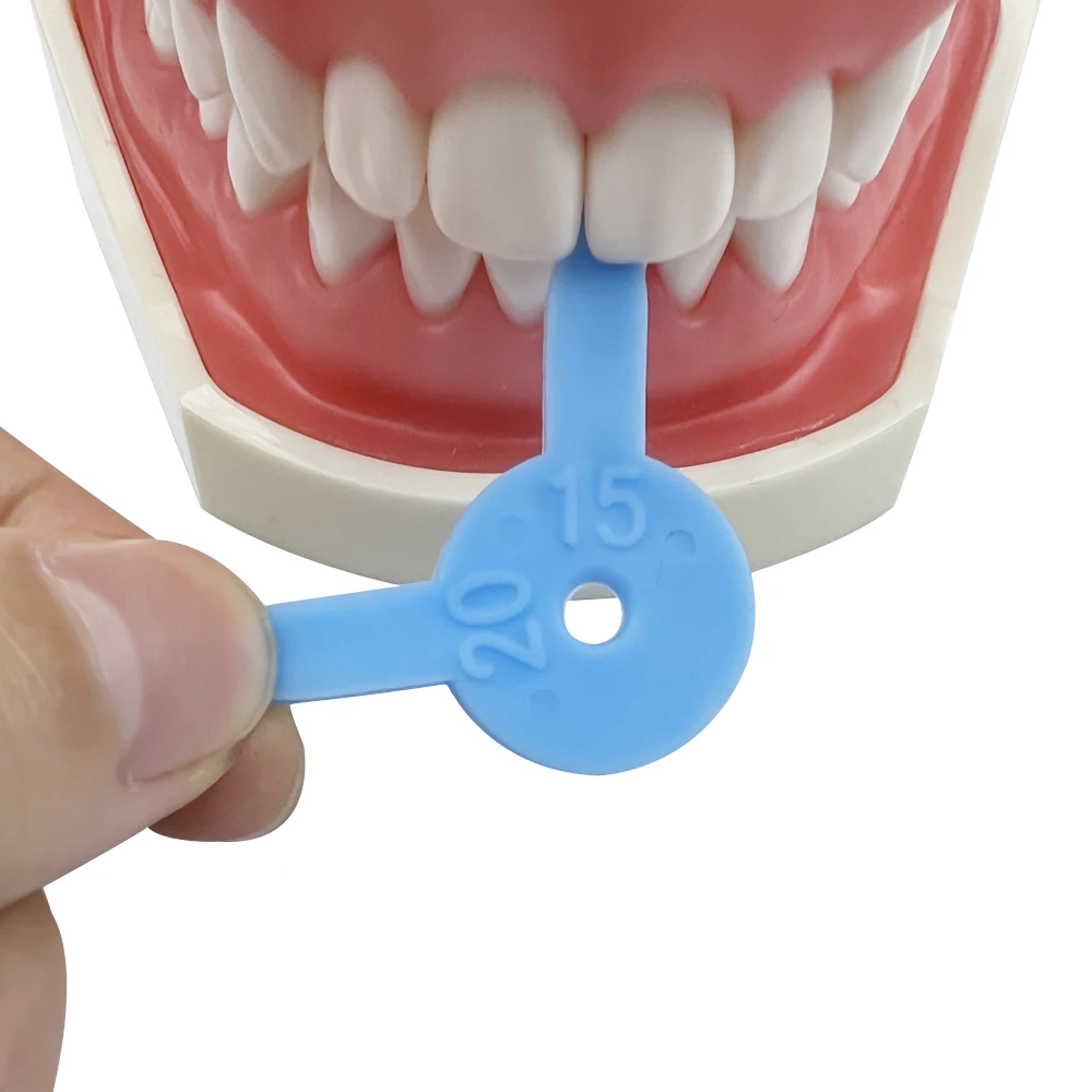 Diastema Denti Superiori: Cause E Rimedi | Wedental Care - Foto 5