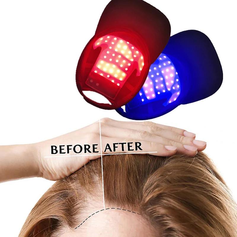 InfraredHairGrowthInstrumentPhysiotherapyHairGrowthCapLaser
