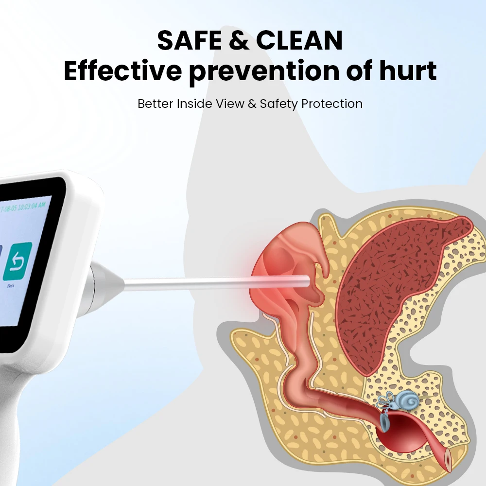 Video Otorhinolaryngoscope Veterinary Portable ENT Video Otoscope 3.2 Inch Touch