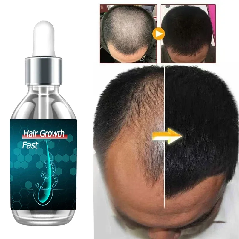 98% of buyers buy again, have more and more hair
