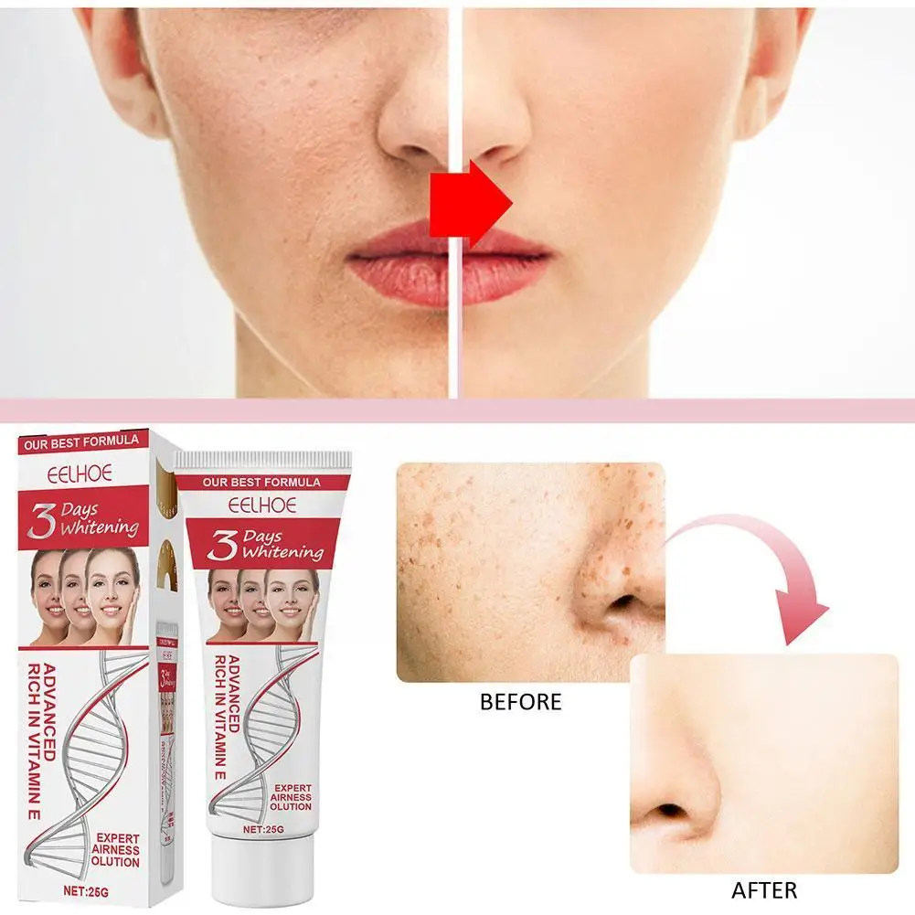 Рисунок 4 - EELHOE 3 дня Kojic кислота Отбеливающая