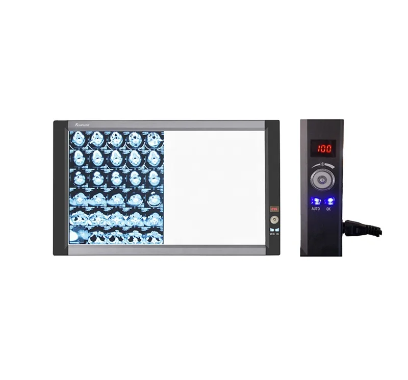 

Hot Sale Manufacturer Supply LED X-ray Film Viewer