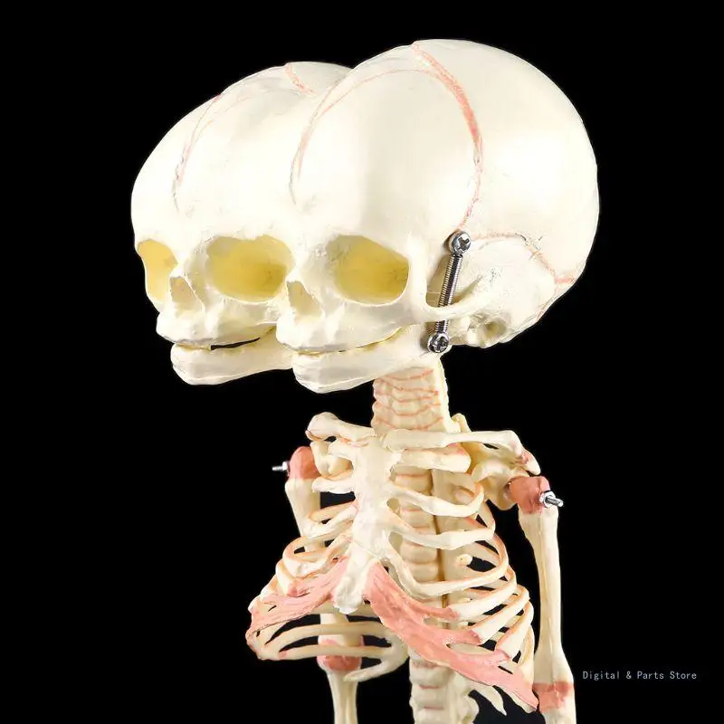 

M17F Human Baby Deformed for Head Skull Research Model Skeleton Anatomical Anatomy Teaching Study Display