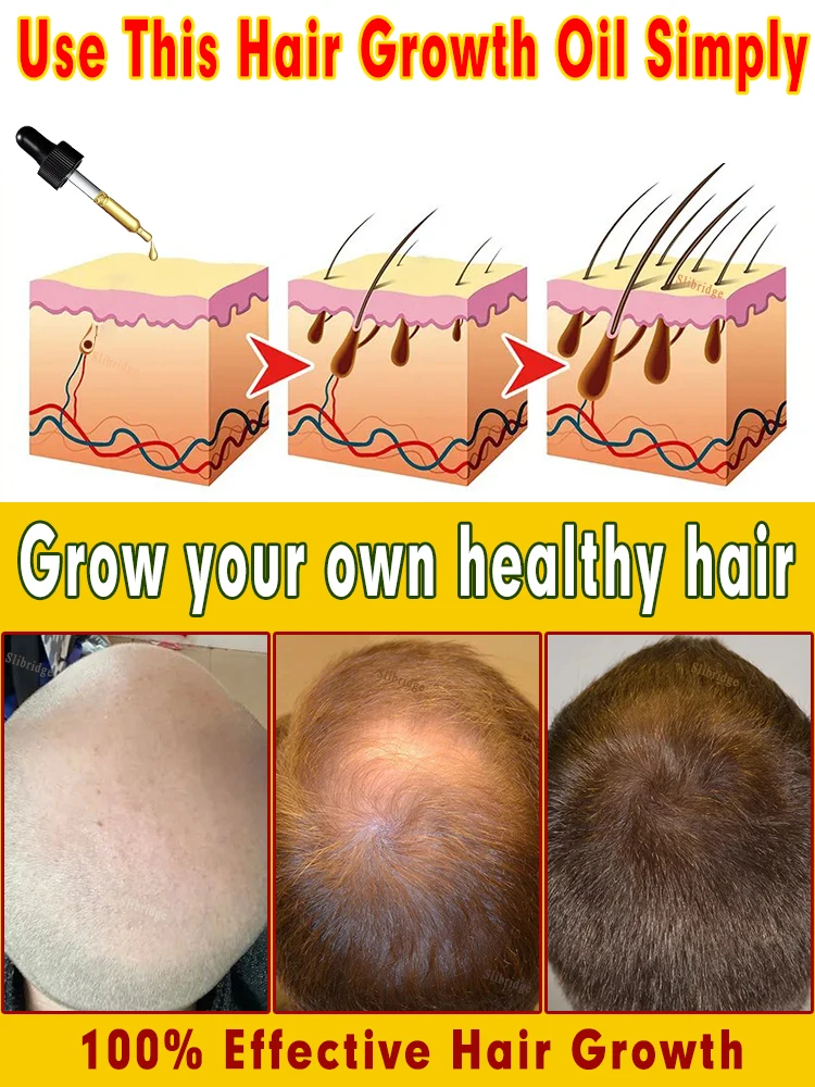 Hair Growth Essential Oils Hair growth essential oils that can make hair grow anywhere