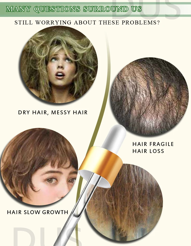 Description Picture 5 of itemGinger Hair Loss Product Authentic 100% Essence Treatment For Men And Women Dry and Damaged Hairs Nutrition Hair Care 30ml