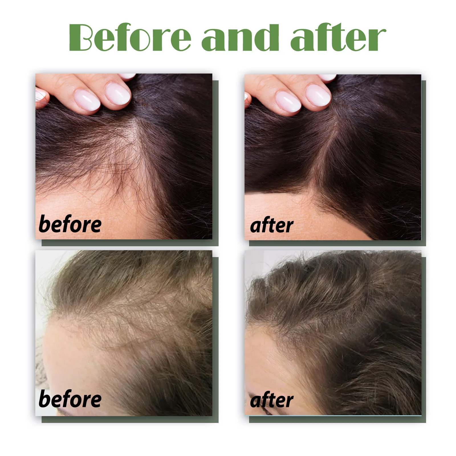 Hair Growth Spray Effective Nourishing Root Hair Thick Growth Liquid Anti Loss Ginger Anti-Fall Scalp Massage Care Spray