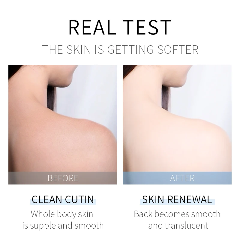 LAIKOU Body Scrub Moisturizing Oil Control Cleaning Softening Chicken Skin Keratin Rubbing Mud Scrub Care Product 100g