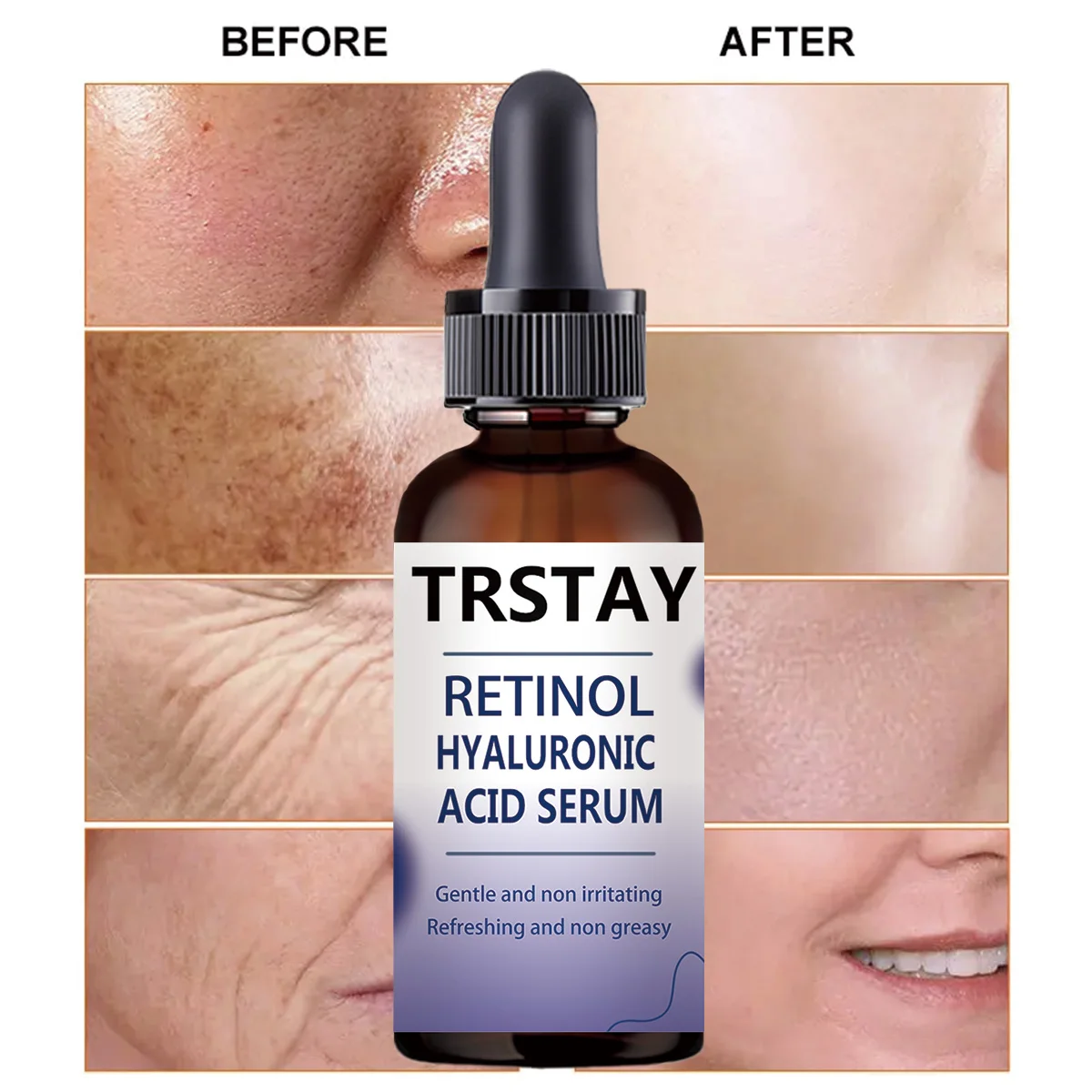 Facial Serum Retinol Hyaluronic Acid Gentle Non-Irritating Refreshing Non-Greasy Helps Improve Skin Condition