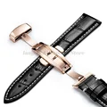 BlackWhite RoseGold