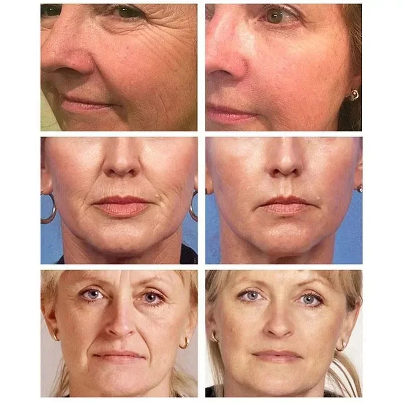 Pure Collagen Face Serum Remove Wrinkle Firming Lifting Anti-Aging Essence Fade Fine Lines Whitening For Moisturizing Skin Care 4