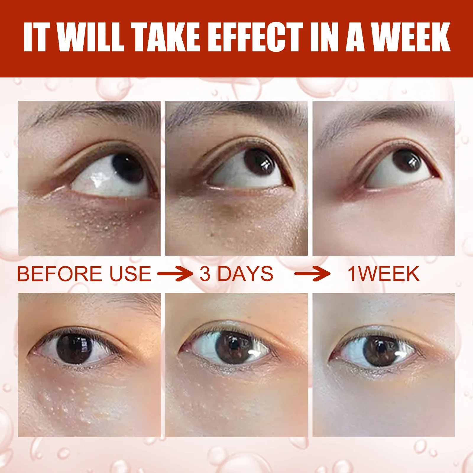 Fat Granules Removal Eye Serum Eye Milia Repair Treatment Products Wrinkle Lifting Moisturizing Anti-Puffiness Korean Skin Care facial serum facial essence retinol face serum salicylic acid facial serum