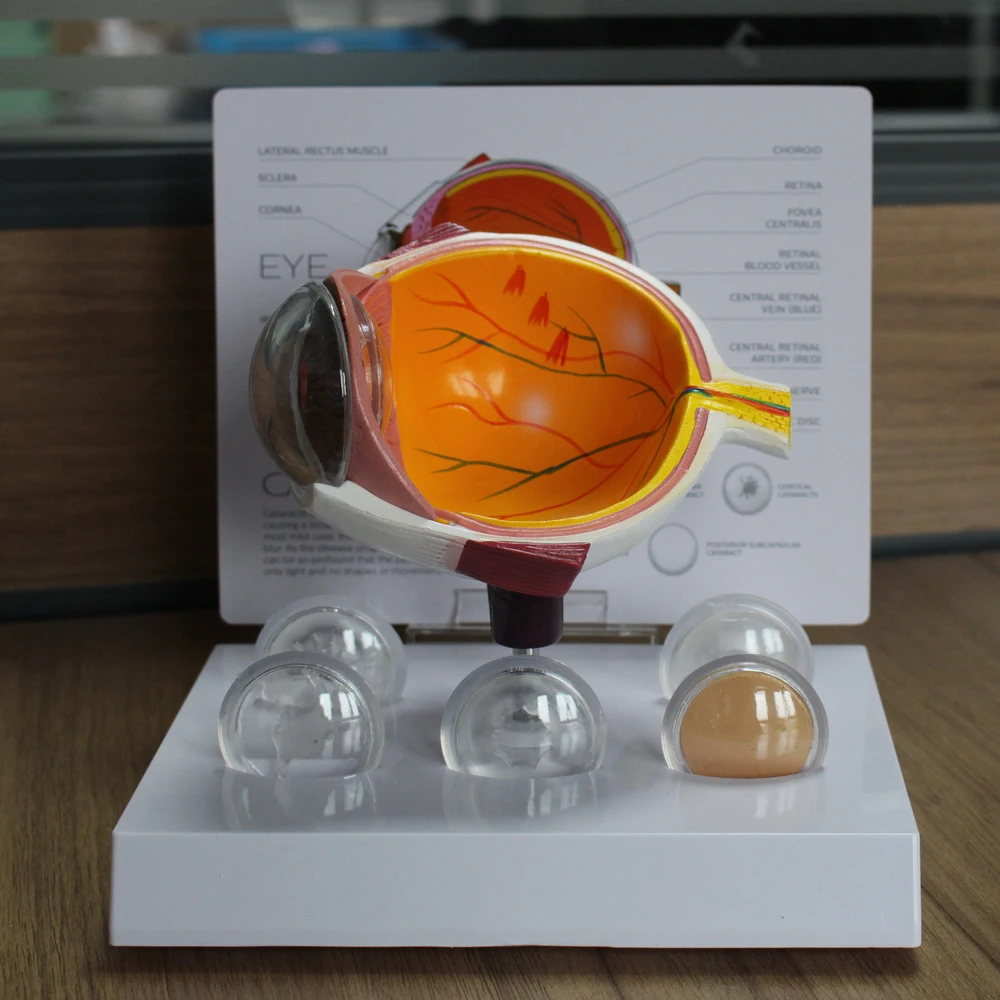 Cornea Eyeball Model Human Eye Demonstration Glaucoma Cataract Anatomy Medical Teaching Tool