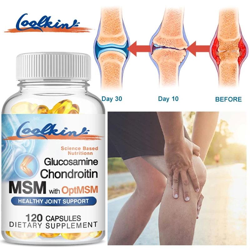 Glucosamine Chondroitin Supplement Glucosamine Chondroitin MSM and OptiMSM Promotes Skin Nail and Joint Health