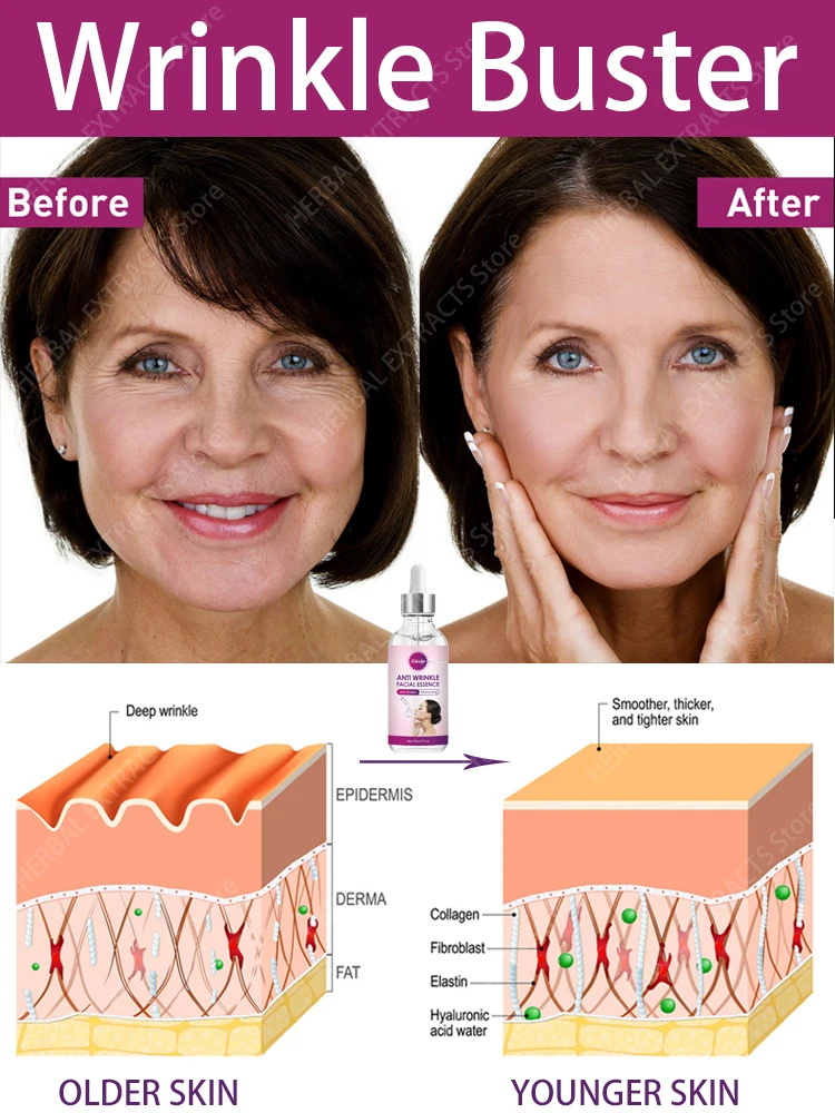 Рисунок 5 - Сыворотка против морщин и старения