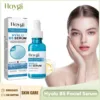 Hyalu B5 Serum Anti-Wrinkle Tightening Fade Fine Line Lifting Hydrating Replenishment Shrink Pore Hyaluronic Acid Facial Essenc 1