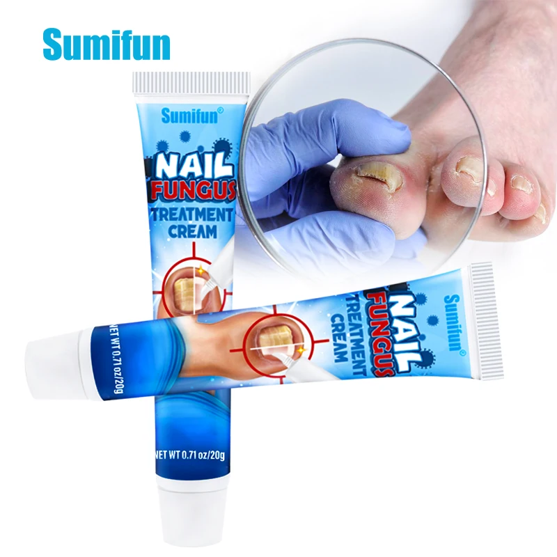 

20g Nail Fungus Treatment Cream Anti Fungal Toe Nails Repair Plaster Anti-Infection Onychomycosis Paronychia Ointment Foot Care
