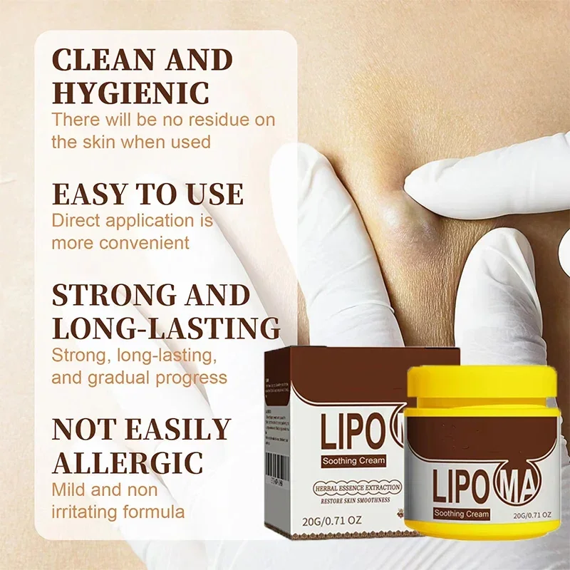 Soothing Cream Subcutaneous Lumps Remover cream lumps remover