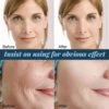 Gold Protein Line Anti-wrinkle Facial Filler Thread Lift Firm Face Serum Absorbable Anti Aging Moisturize Repair Skin Care 2