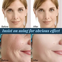 Gold Protein Line Anti-wrinkle Facial Filler Thread Lift Firm Face Serum Absorbable Anti Aging Moisturize Repair Skin Care 2
