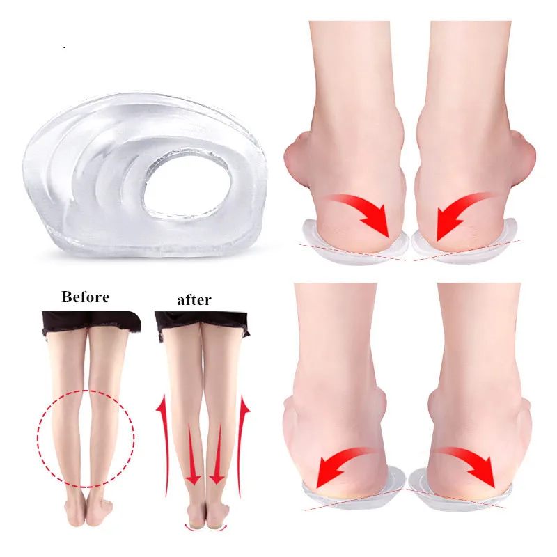 Nuevas plantillas de tacón para hombres y mujeres, plantillas para zapatos, cojín tipo X, almohadilla ortopédica para pierna tipo O, Corrector Varus Valgus_voghion.com