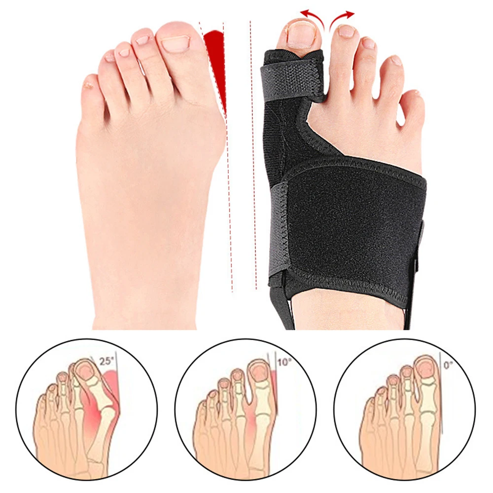 Toe Corrector Orthotics Bone Thumb Adjuster Hammer Protector Hallux Valgus Bunion Orthopedic Tool