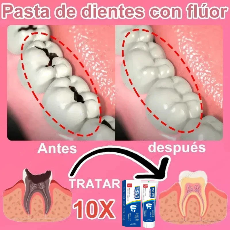 Repair Tooth Decay toothpaste toothpaste squeezer teeth health product