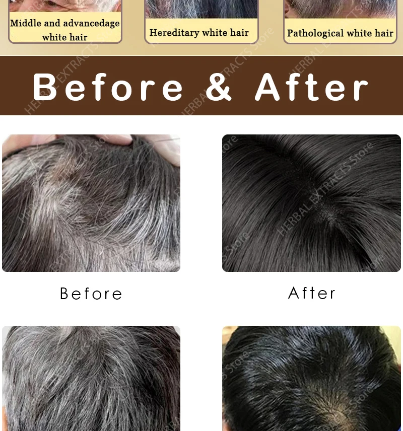 Description Picture 5 of itemAnti Gray Hair Serum White Darkening Natural Hair Color