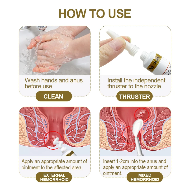 2Pcs Hemorrhoids Ointment Internal Piles External Anal Fissure Cream Relief Anal Pain Swelling Itch Chinese Medicine Cream A1956