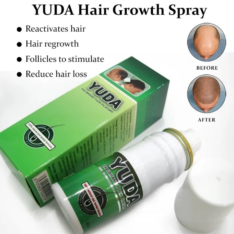 Bald head treatment YUDA and FEG hair regrowth new hair loss treatments ANTI HAIR LOSS SPRAY kit
