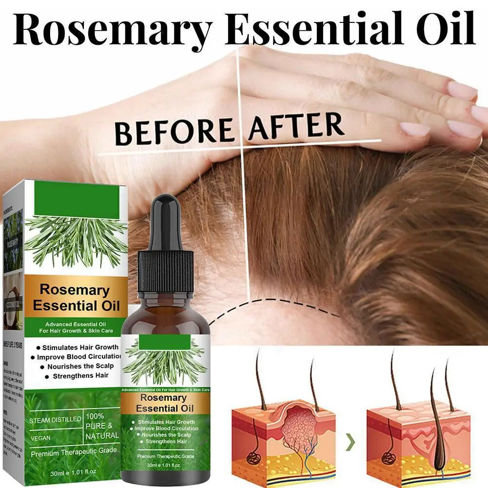 Essential Oil Scalp & Hair Strengthening Rosemary Oil for Hair Growth Repair Damaged Care 30ml Anti Loss