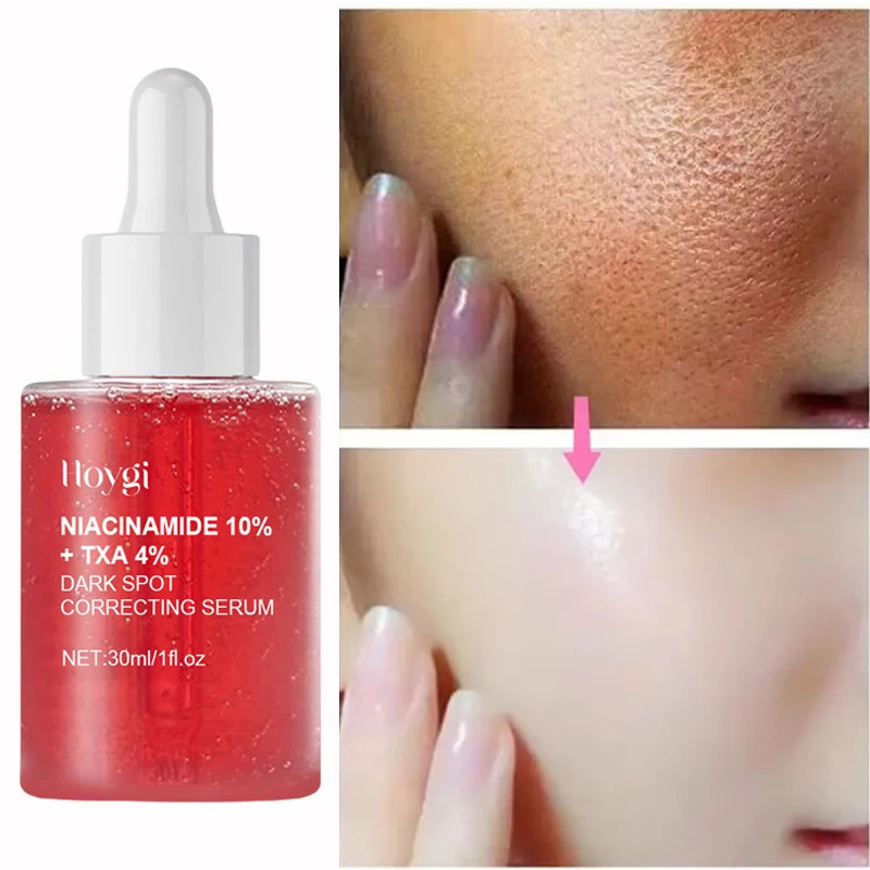 Dark Correcting Essence 10% Niacinamide+ 4% Tranexamic For Post-Acne Marks Acne Hyperpigmentation Even Skin Tone Serum facial essence