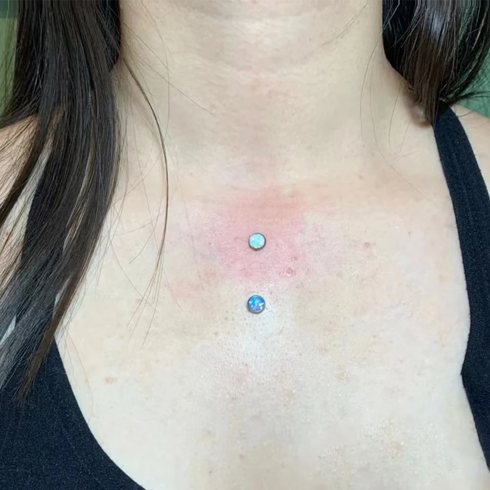 Dermal On Chest