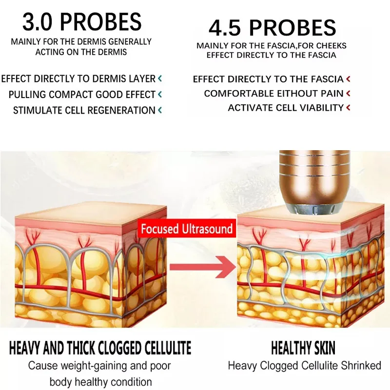High Frequency Ultrasonic Facial Beauty Machine  Skin Tighten Anti WrinkleSkin Rejuvenation Face Lift Tool Radar Line Carve Tool 6