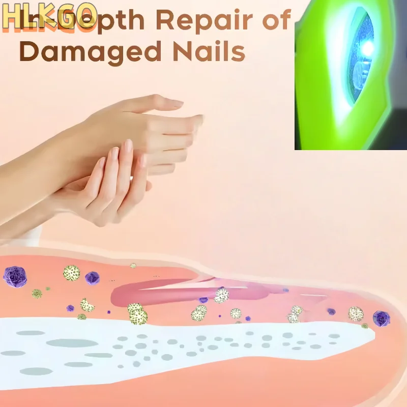 Smart Nail Fungus Laser Device Automatic Toenail Treatment Equipment for Fungus Removal Painless and Effective