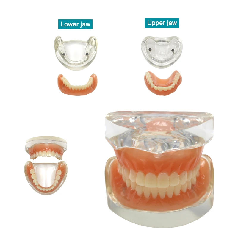 

Модель зубного импланта, съемный внутренний мандибулярный нижний слой с имплантатом, демонстрационная модель зубов, стоматологические материалы