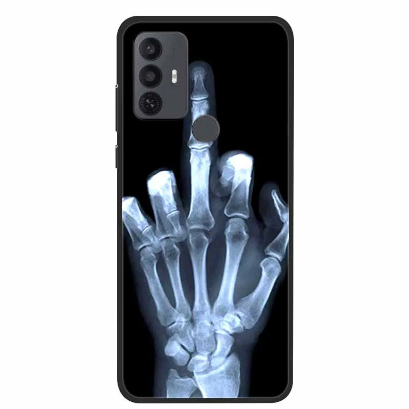 Luxury Soft Silicone Protective Animal Design Phone Case Cover, Cartoon TPU
