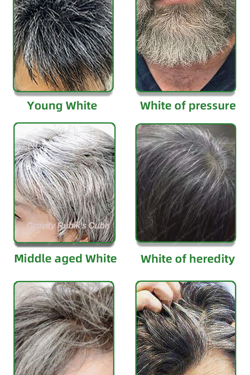 Description Picture 4 of itemAnti Gray Hair Serum Remedy