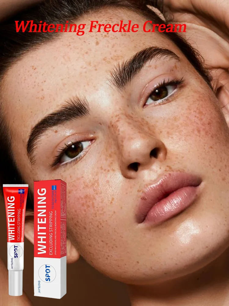 

Whitening Freckle removal Cream Brighten Tone Dark Spots Removal Fade Spots Melasma Brightening Anti-acne Moisturizing Skin Care