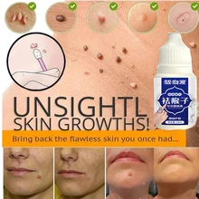 

1pcs Skin Tag Remover Genital Wart Treatment Instant Removal Mole&Papillomas Foot Corn Repair Tool Natural Bacteriostatic Liquid