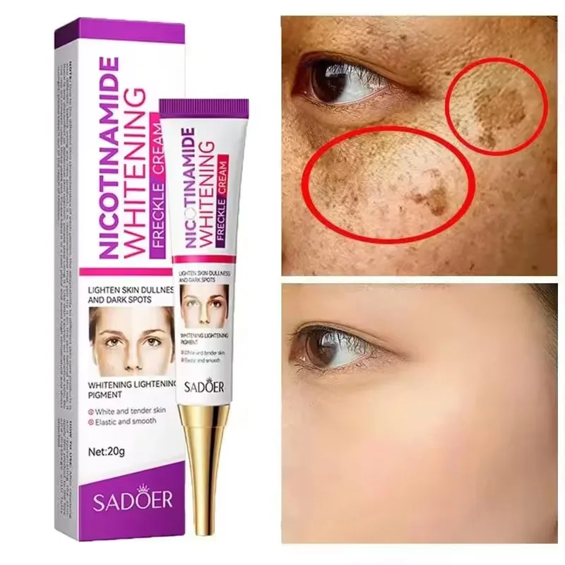 Freckle Removing Face Cream 1