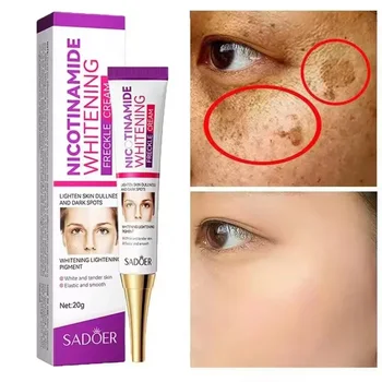 Freckle Removing Cream Nicotinamide Face Cream 1