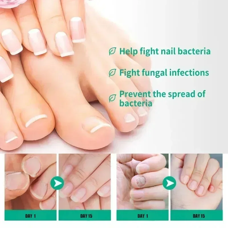Stay away from bad nails Get beautiful nails nail problem solving nail repair