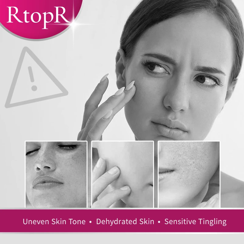 Bělicí krém na obličej Odstraňování pih Proti vráskám Jemné linky Proti stárnutí Hydratační Výživný Extrakt s vitamínem C Krása Zdraví_voghion.com