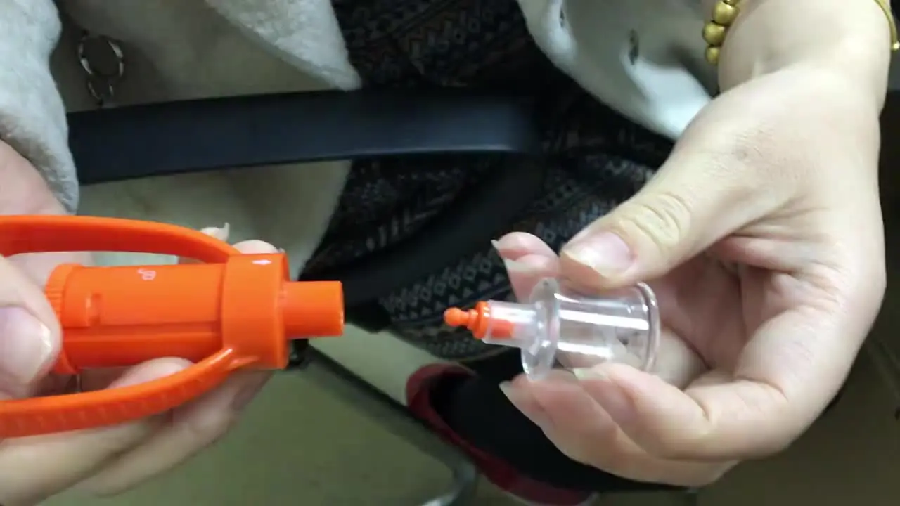 Estrattore Per Punture Di Insetti - Ventosa Per Veleno, Ideale Per Escursionismo E Emergenze - Foto 3