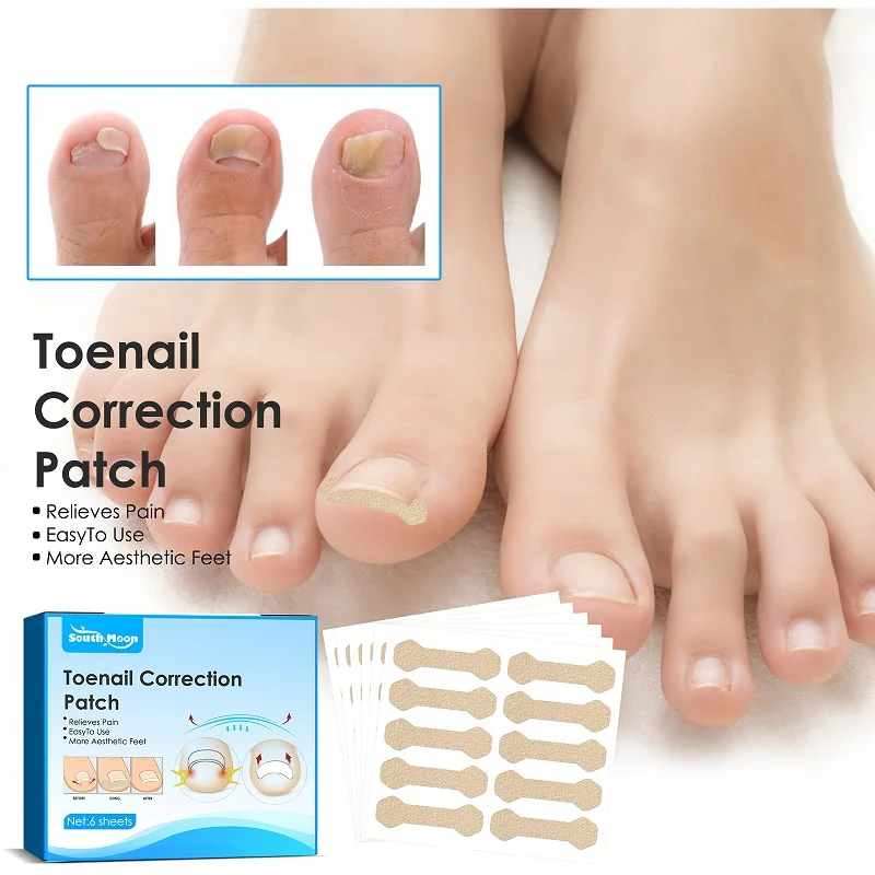 60pcsIngrownToenailCorrectorStickerParonychiaTreatmentNailStripToeInlayNailCorrector